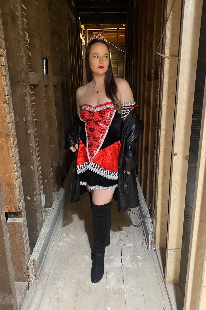 Patients 20-39 Years Old Before & After Gallery - Patient 177282 - Image 2