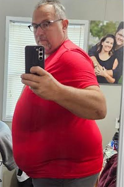 Patients 40-59 Years Old Before & After Gallery - Patient 203291 - Image 1