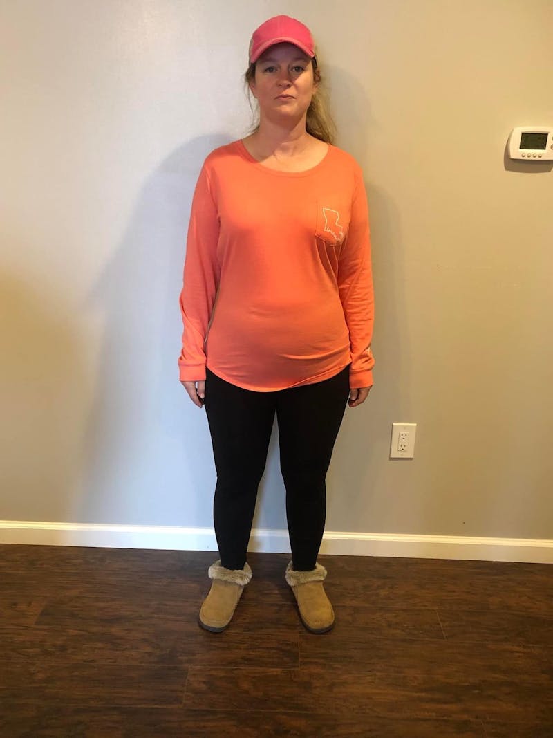 Patients 40-59 Years Old Before & After Gallery - Patient 600196 - Image 1