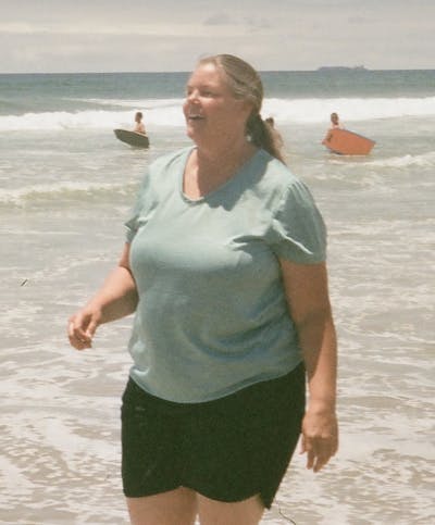 Patients 40-59 Years Old Before & After Gallery - Patient 130321 - Image 1