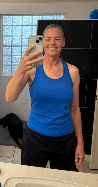 Patients 40-59 Years Old Before & After Gallery - Patient 130321 - Image 2