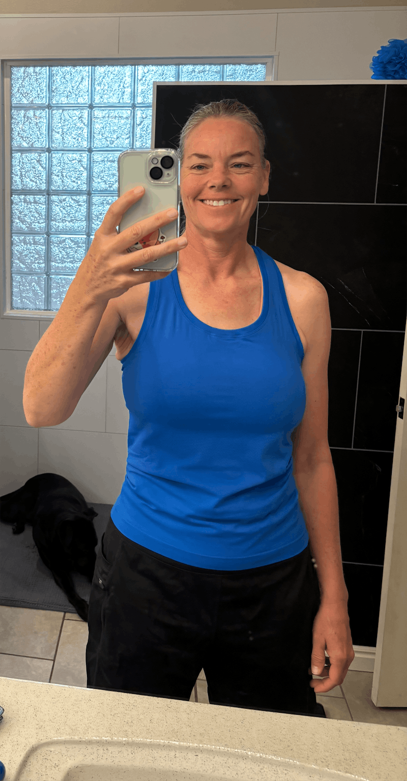 Patients 40-59 Years Old Before & After Gallery - Patient 130321 - Image 2