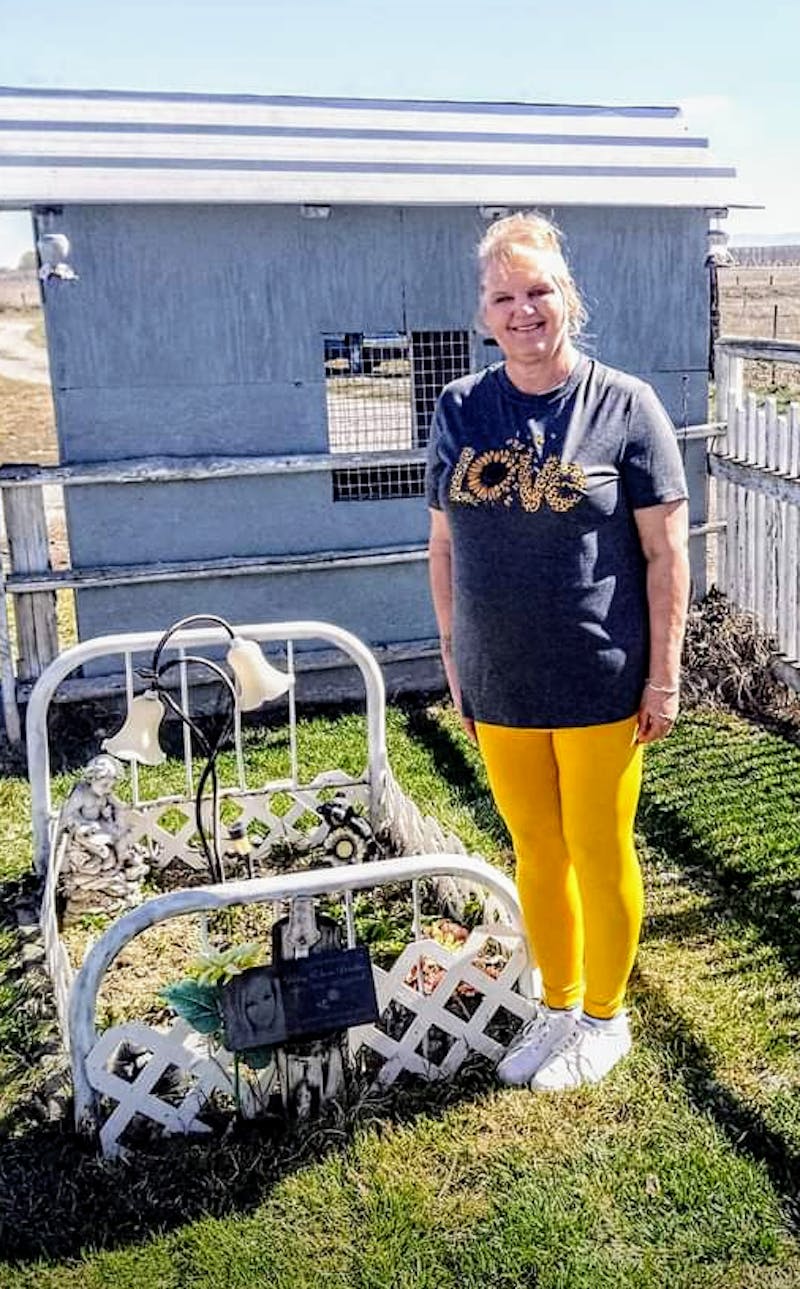 Patients 40-59 Years Old Before & After Gallery - Patient 370816 - Image 2