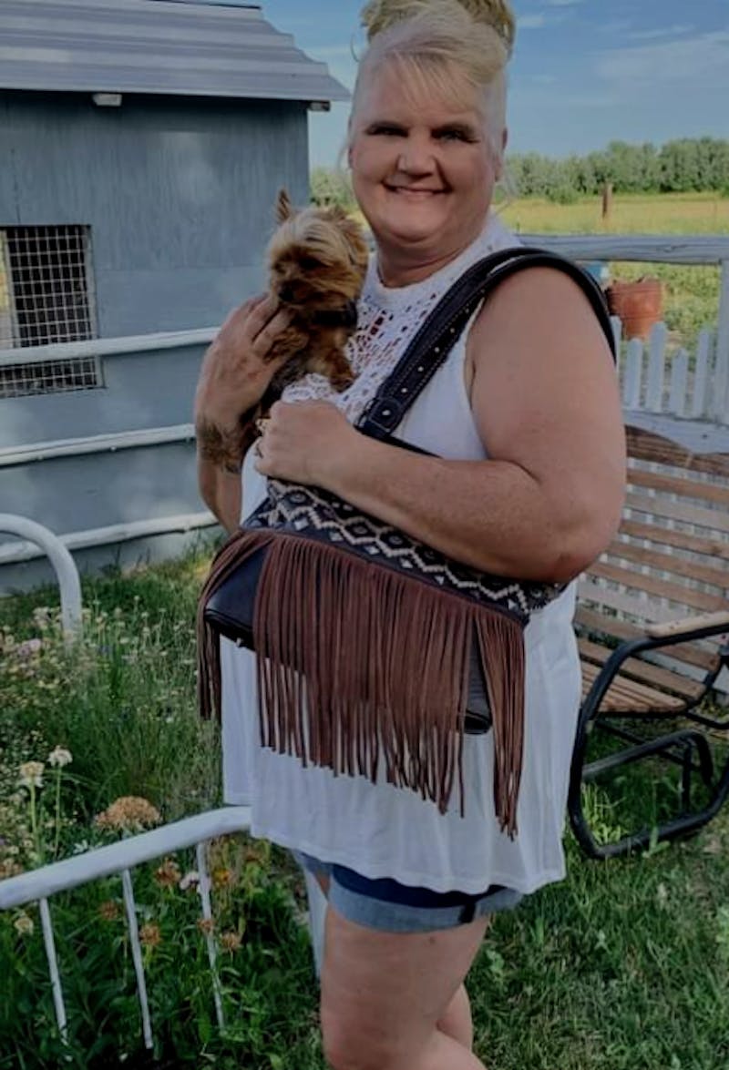 Patients 40-59 Years Old Before & After Gallery - Patient 370816 - Image 1