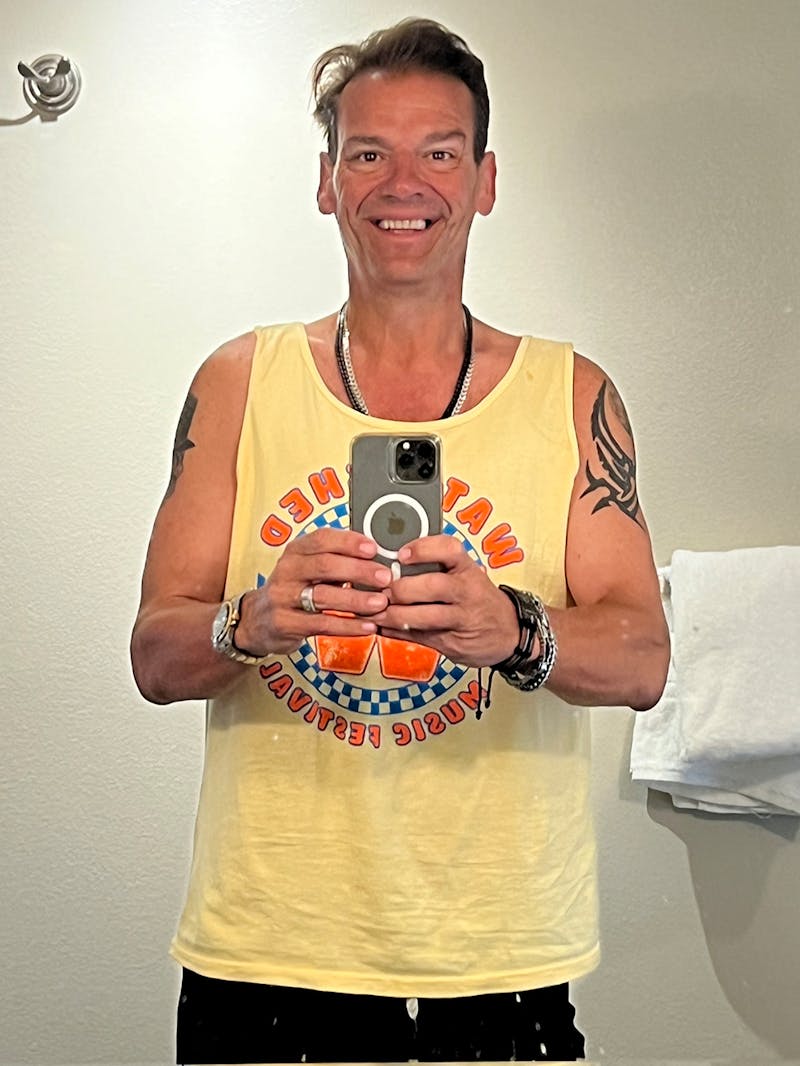 Patients 40-59 Years Old Before & After Gallery - Patient 397632 - Image 2