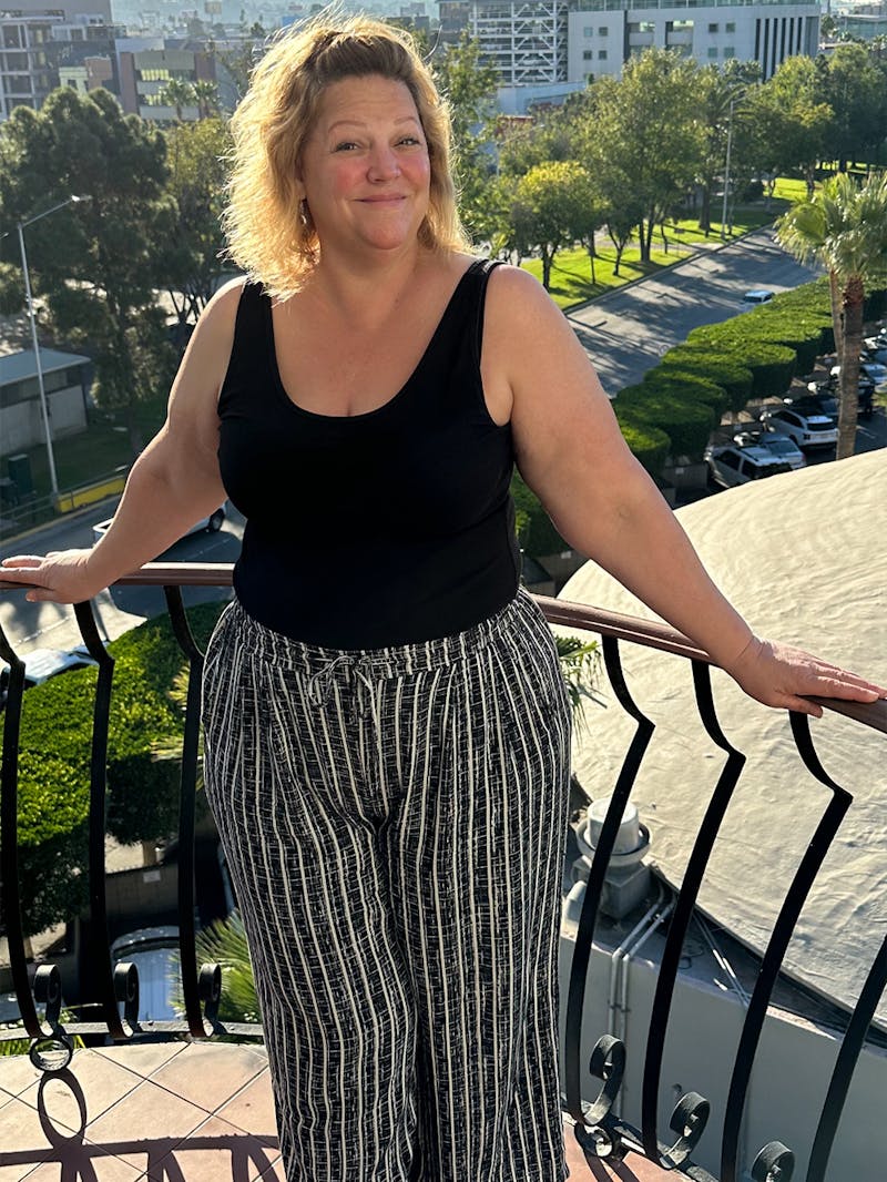 Patients 40-59 Years Old Before & After Gallery - Patient 179181 - Image 1