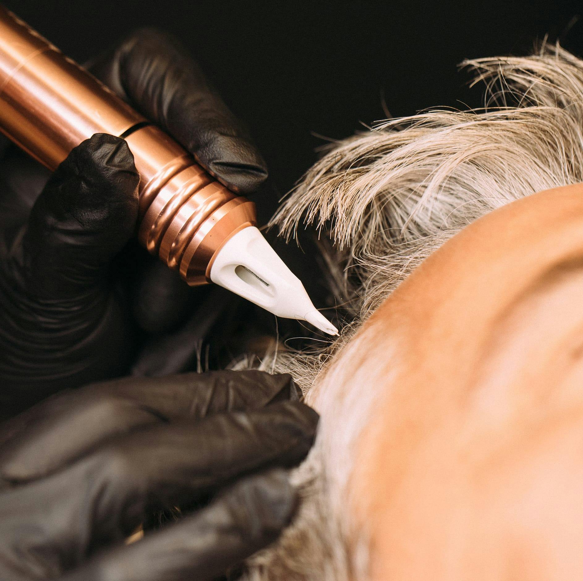 close up picture of a scalp micropigmentation and a scalp