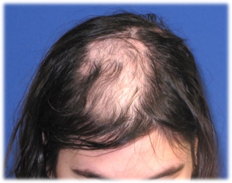 Non-Surgical Before & After Gallery - Patient 31411837 - Image 1