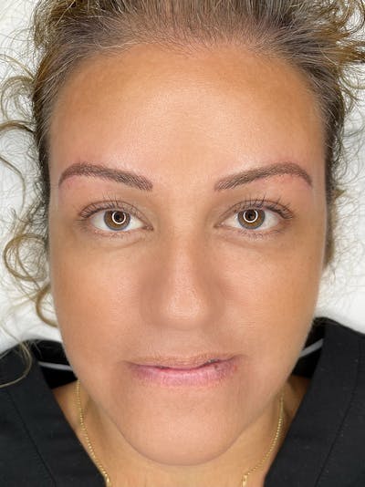 Microblading Before & After Gallery - Patient 41625639 - Image 2