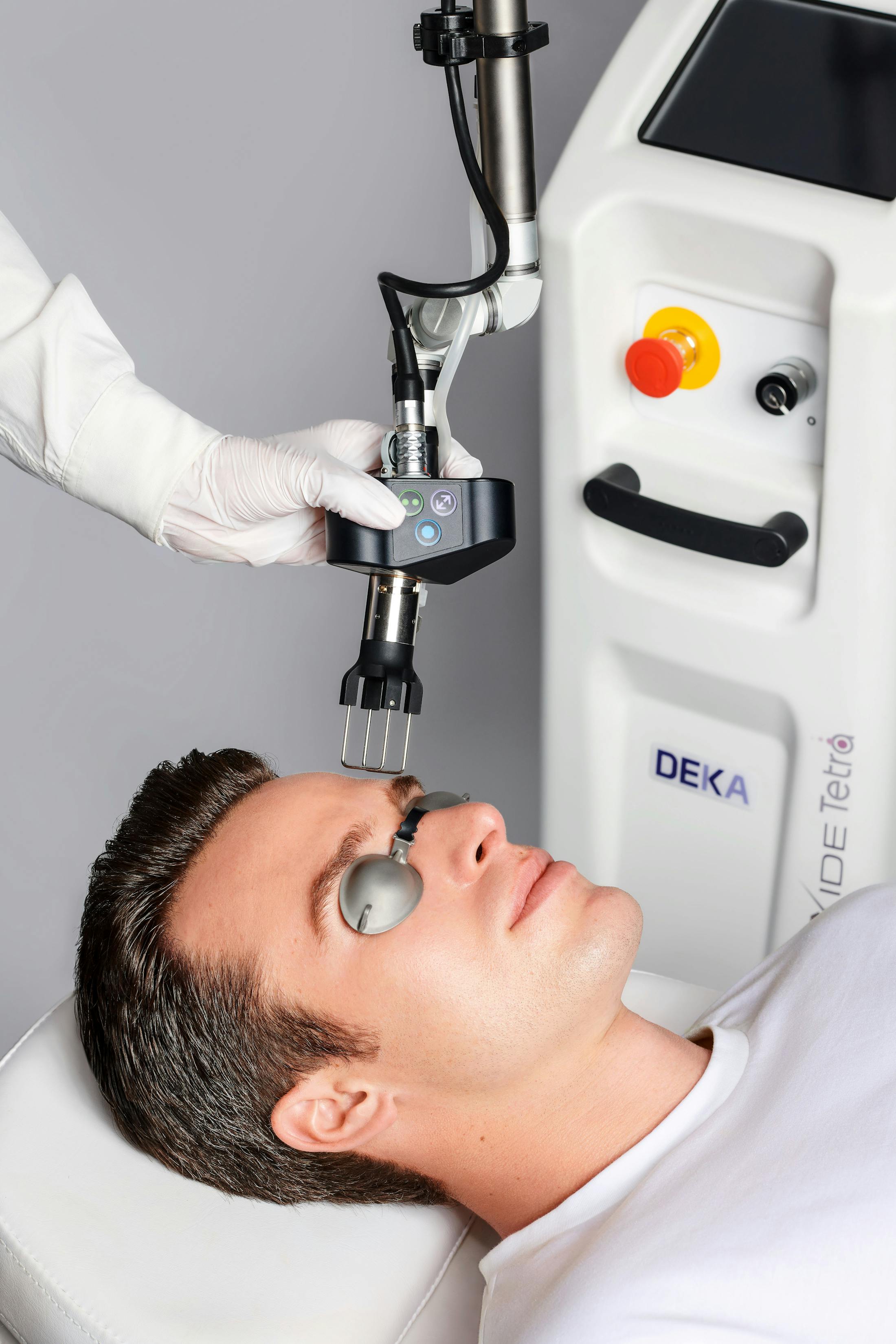 man recieving CO2 laser in Sarasota