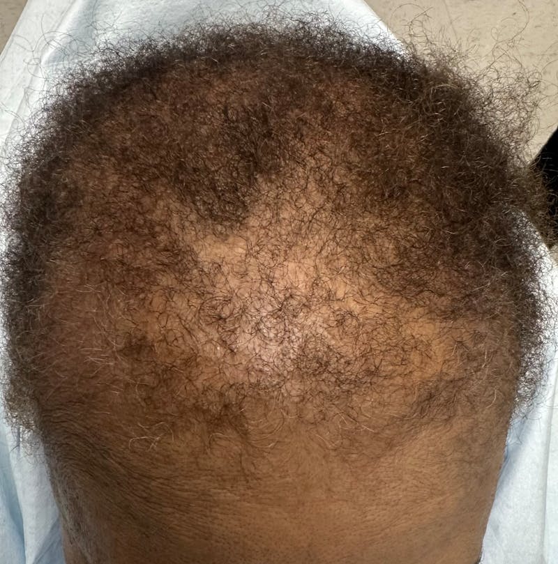 Non-Surgical Before & After Gallery - Patient 467589 - Image 3