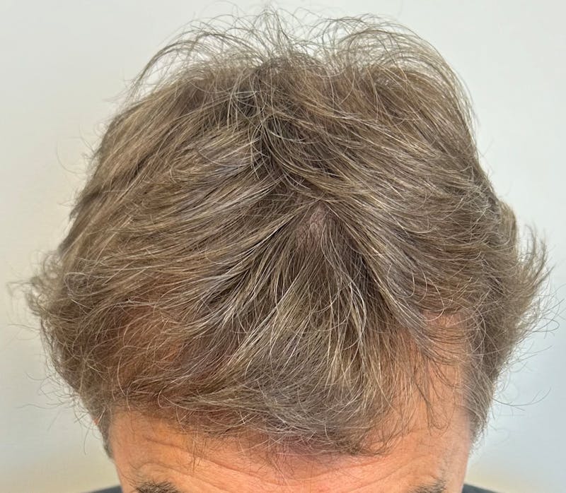 Surgical Before & After Gallery - Patient 246729 - Image 2