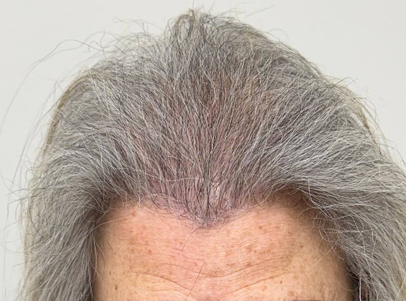 Surgical Before & After Gallery - Patient 586558 - Image 2