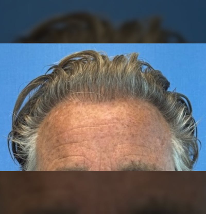 Surgical Before & After Gallery - Patient 307075 - Image 4