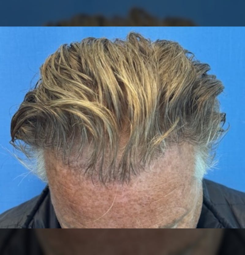 Surgical Before & After Gallery - Patient 307075 - Image 2