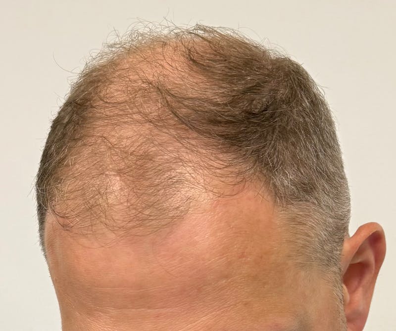 Surgical Before & After Gallery - Patient 558384 - Image 9