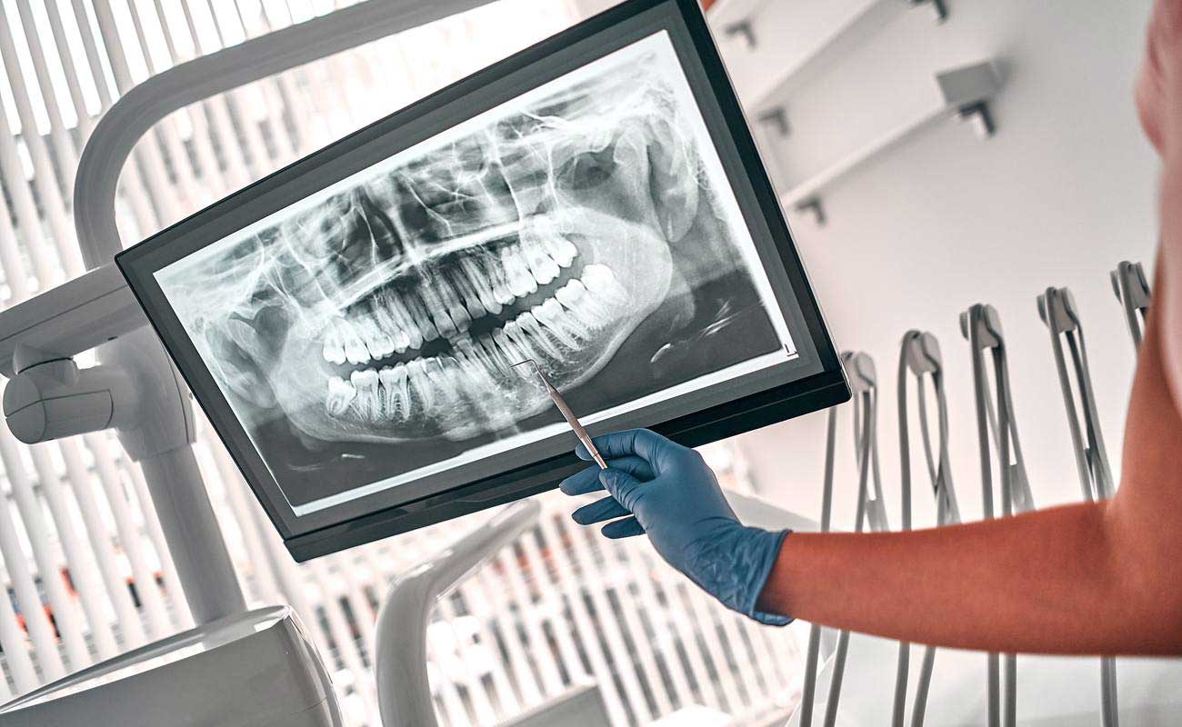 Dental x-ray