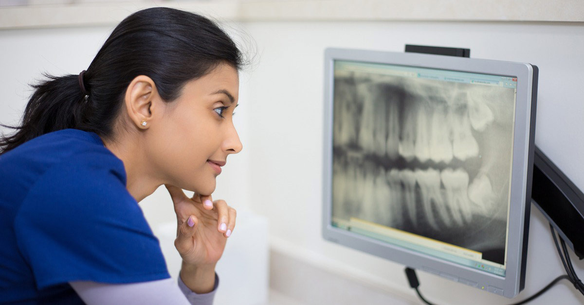 Dental Radiographer looking at a dental x-ray