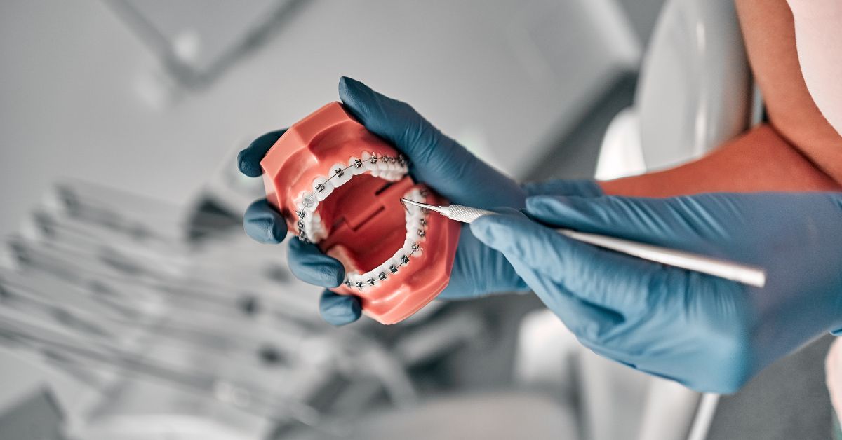 Dental assistant  holding a sample of jaw teeth in a dental office