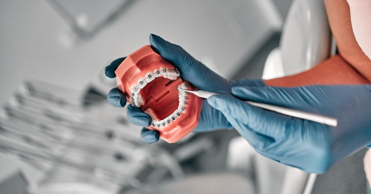 Dental assistant holding a sample of jaw teeth in a dental office