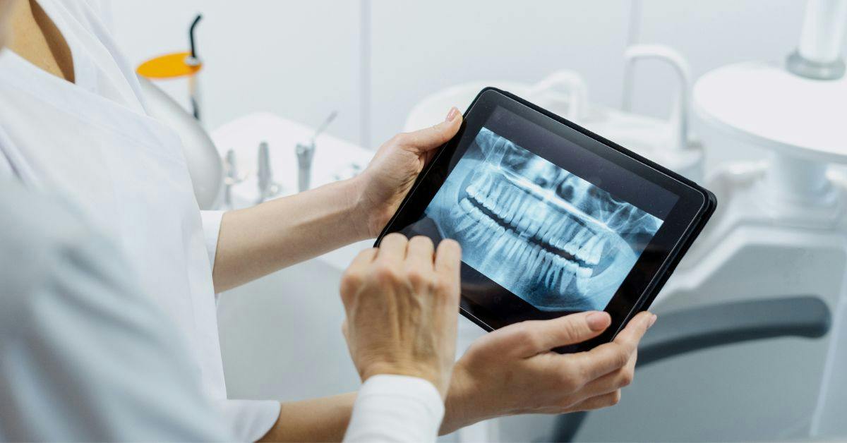 Dental professional reviewing a panoramic dental X-ray on a tablet