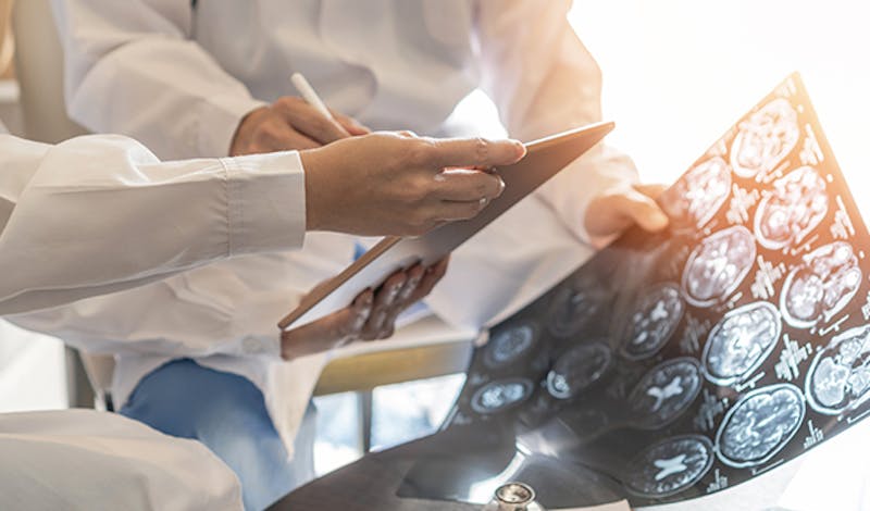 Doctor looking at scans of a brain