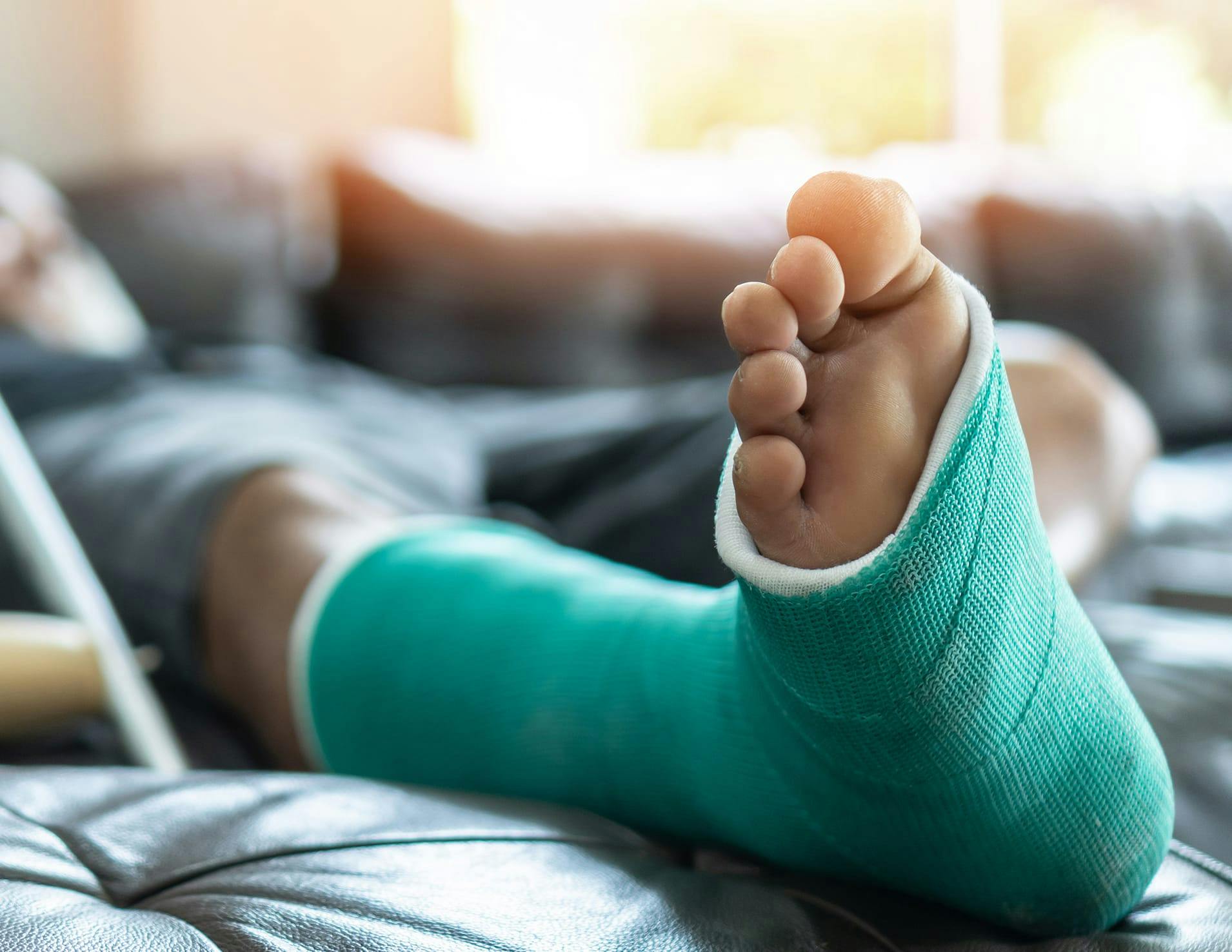 A leg with a blue cast on it