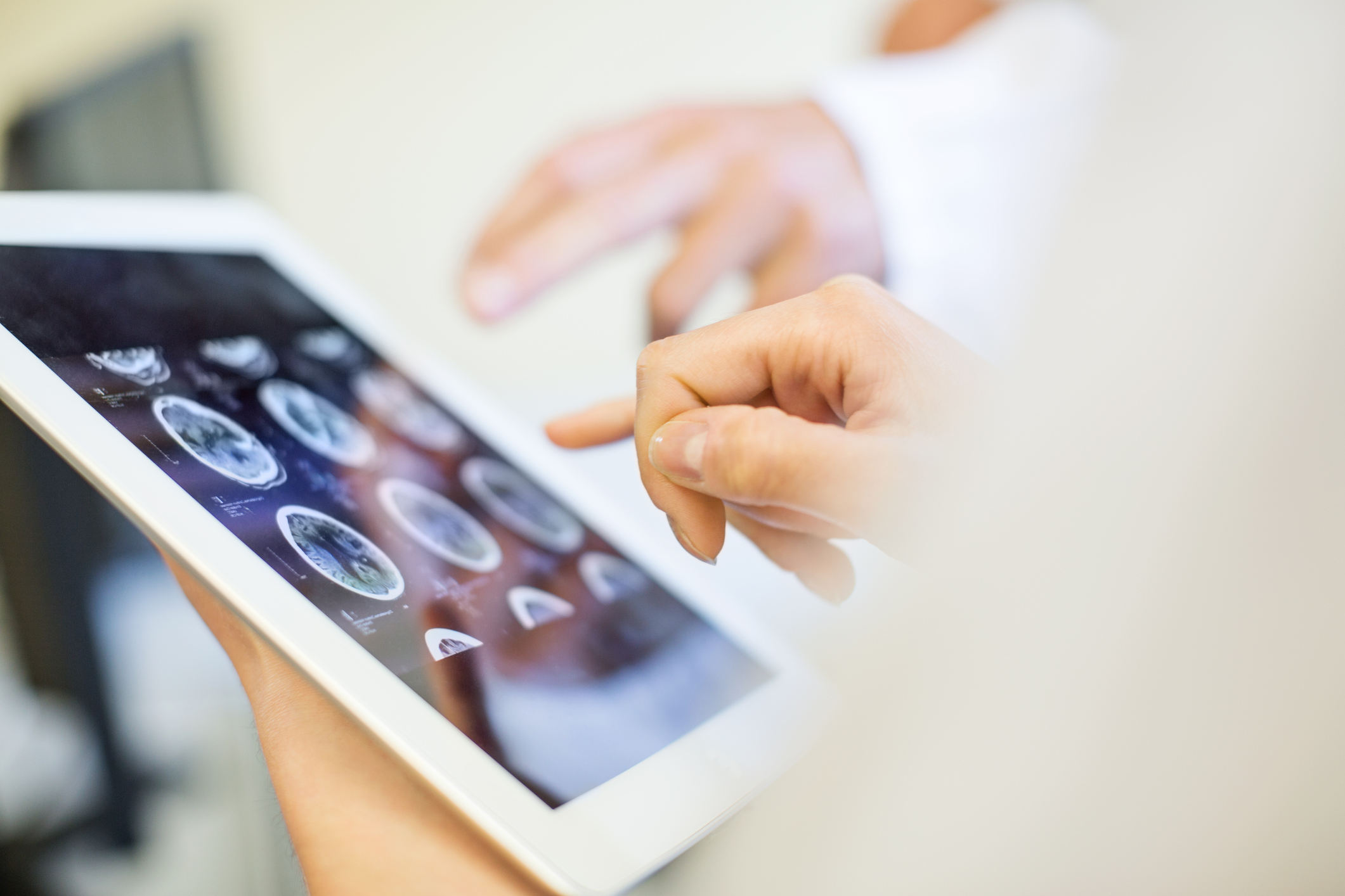Two people look at brain scans on an ipad