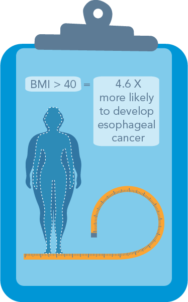 Esophageal Cancer Statistics Roller Weight Loss
