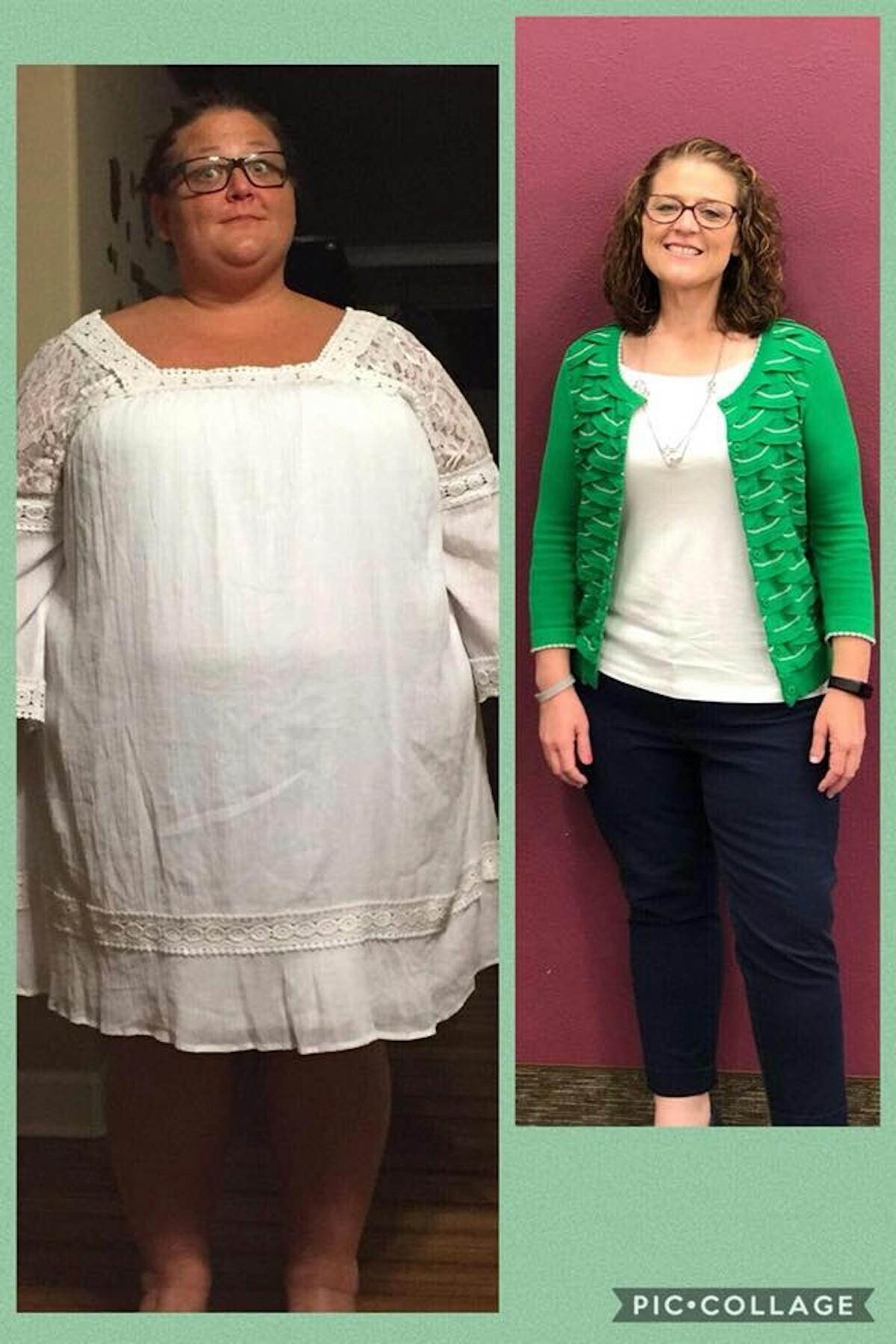 Medical Weight Loss in Tulsa Before & After Photos
