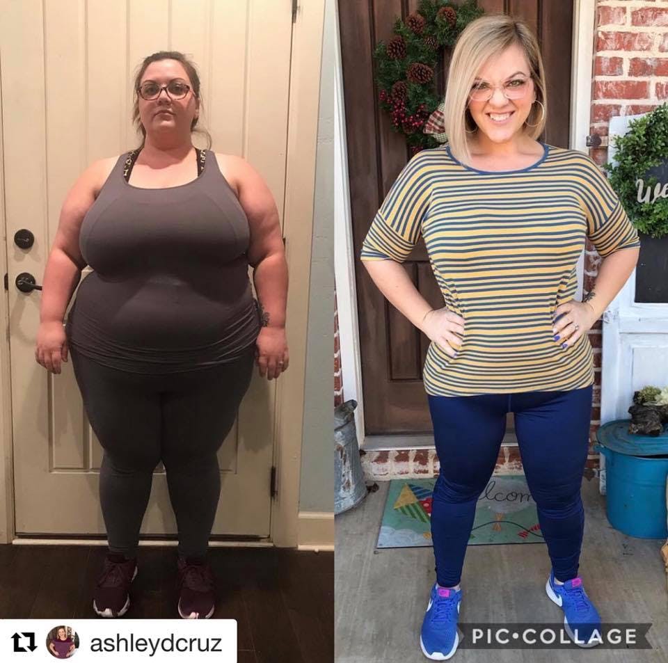 Patient Before & Afters Before & After Gallery - Patient 39360569 - Image 2