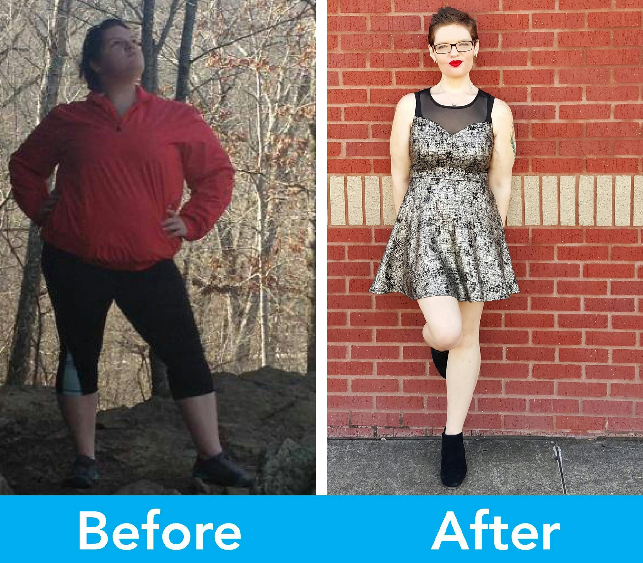 Patient Before & Afters Before & After Gallery - Patient 39360576 - Image 1