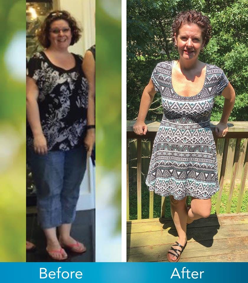 Patient Before & Afters Before & After Gallery - Patient 39360602 - Image 1