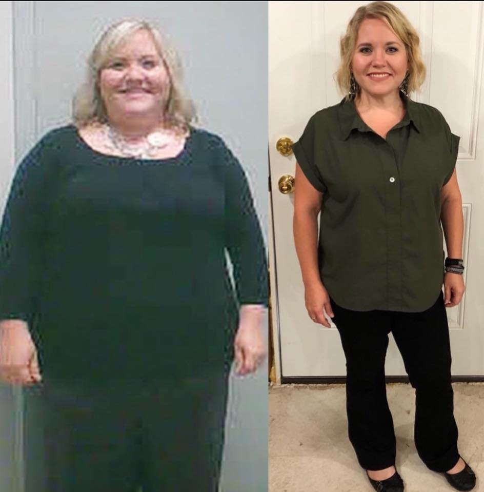 Patient Before & Afters Before & After Gallery - Patient 39360619 - Image 1