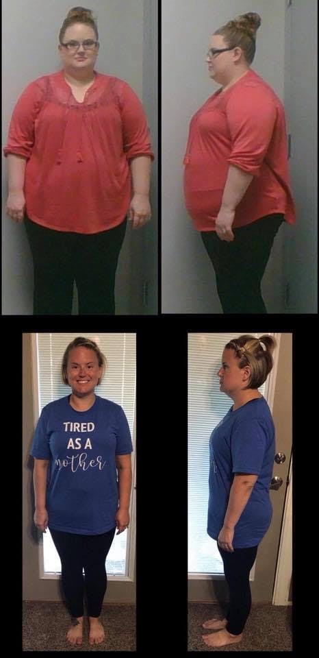 Patient Before & Afters Before & After Gallery - Patient 39360627 - Image 1