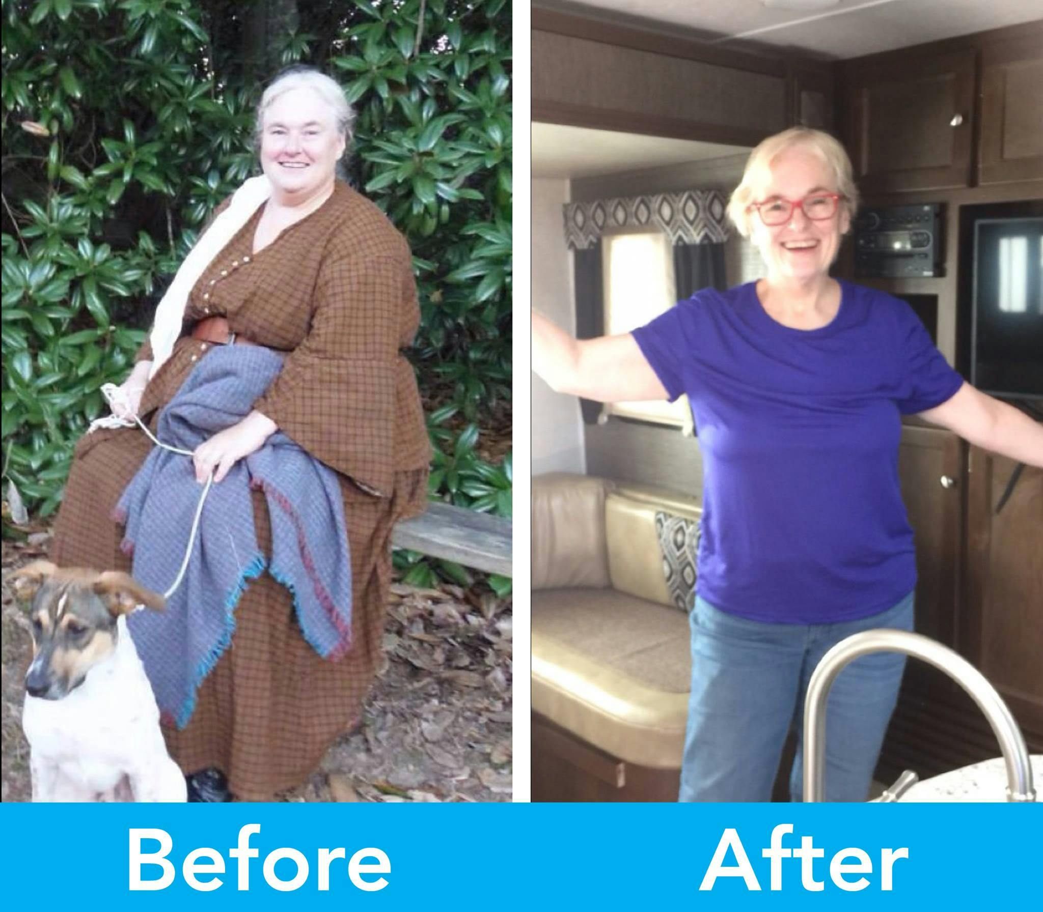 Patient Before & Afters Before & After Gallery - Patient 39360629 - Image 1