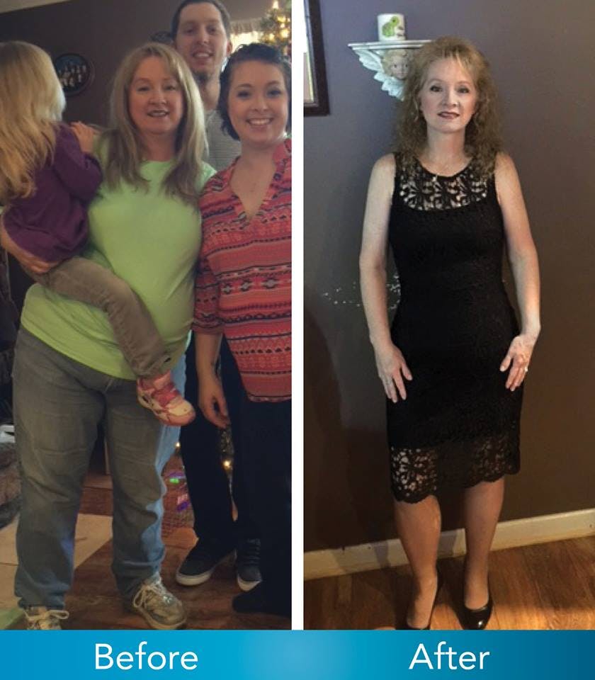 Patient Before & Afters Before & After Gallery - Patient 39360638 - Image 1