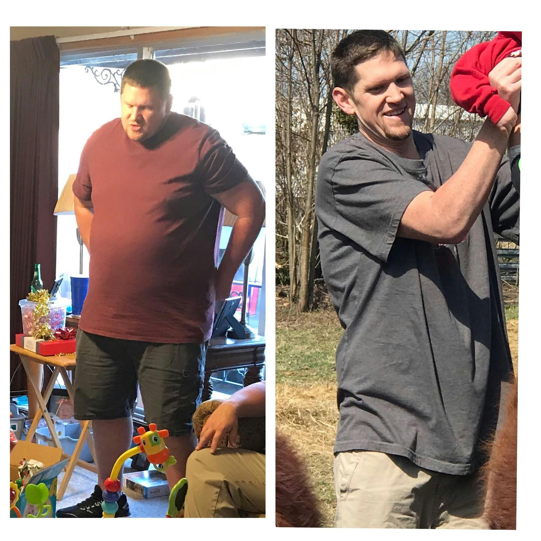Patient Before & Afters Before & After Gallery - Patient 39360642 - Image 1
