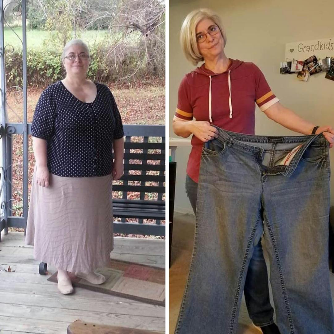 Patient Before & Afters Before & After Gallery - Patient 39360643 - Image 1