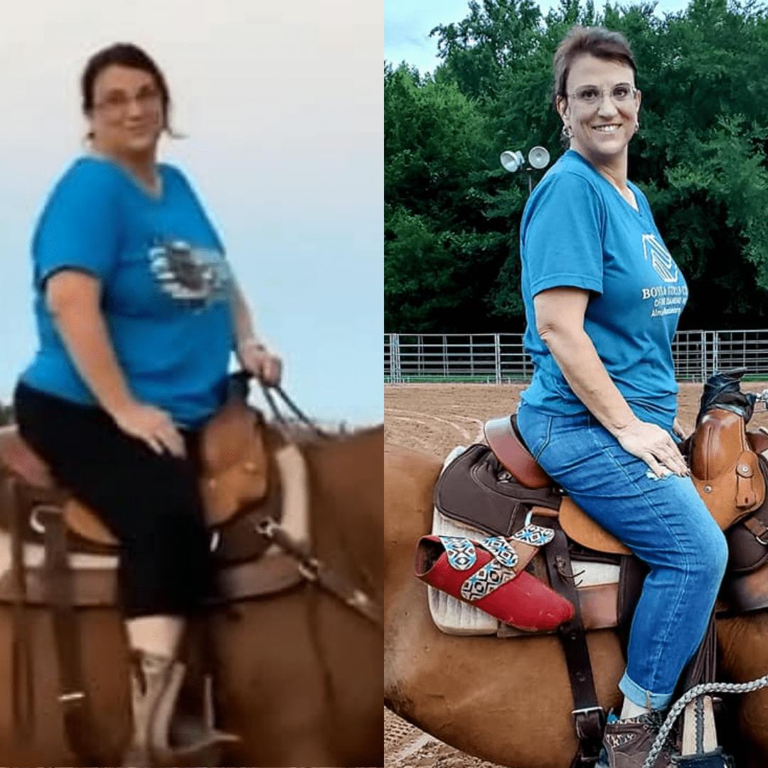 Patient Before & Afters Before & After Gallery - Patient 39360655 - Image 1