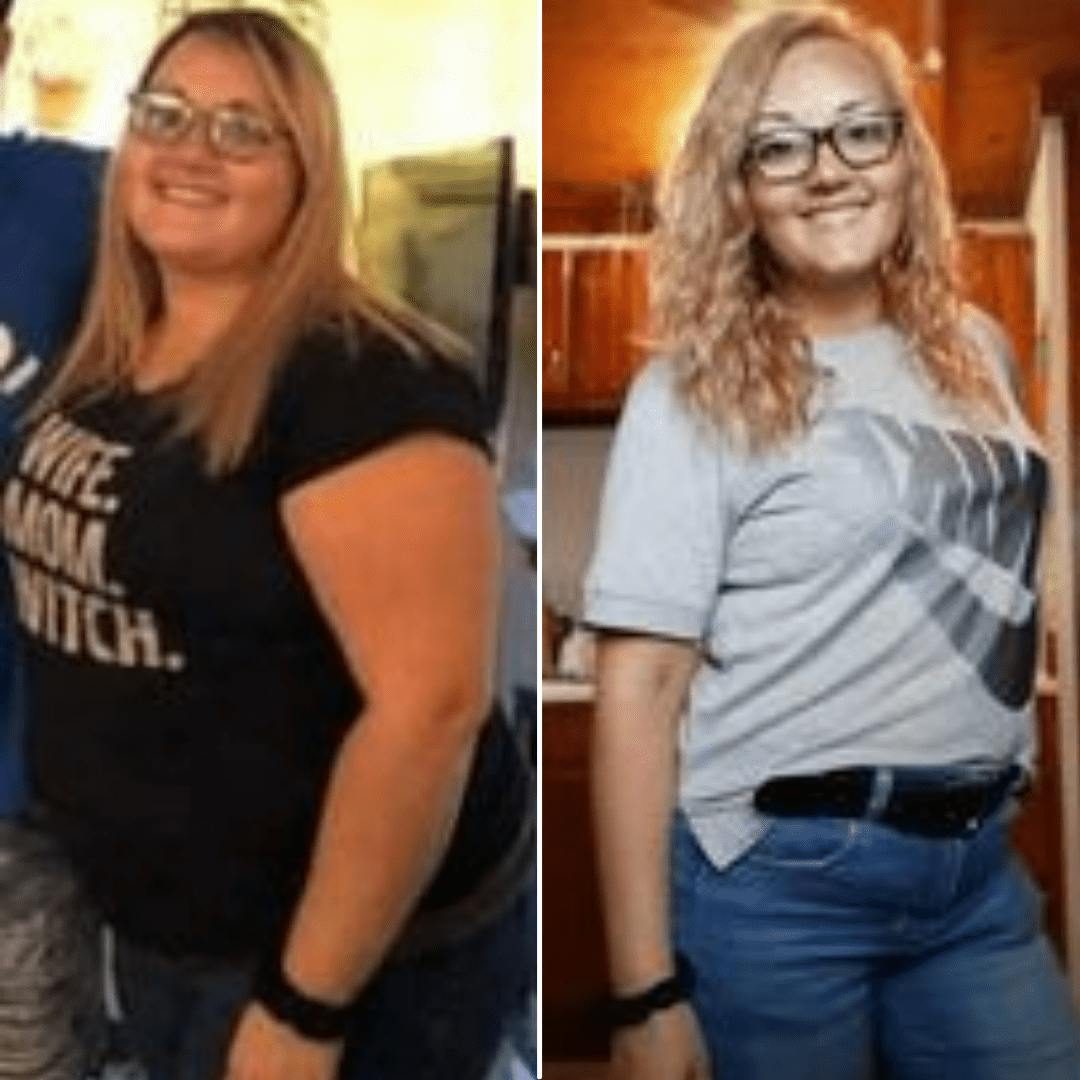 Patient Before & Afters Before & After Gallery - Patient 39360662 - Image 1