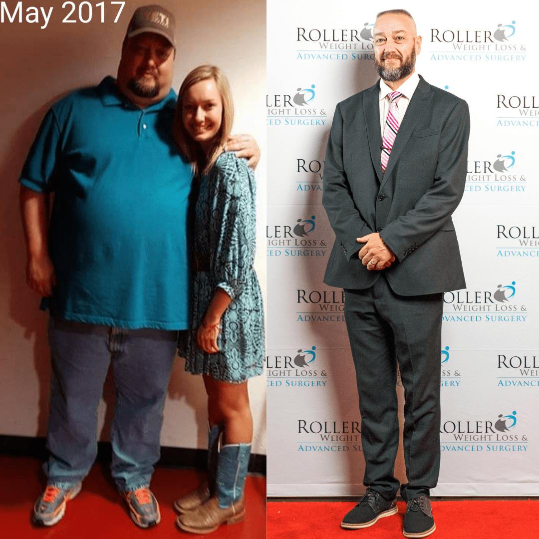 Patient Before & Afters Before & After Gallery - Patient 39360667 - Image 1
