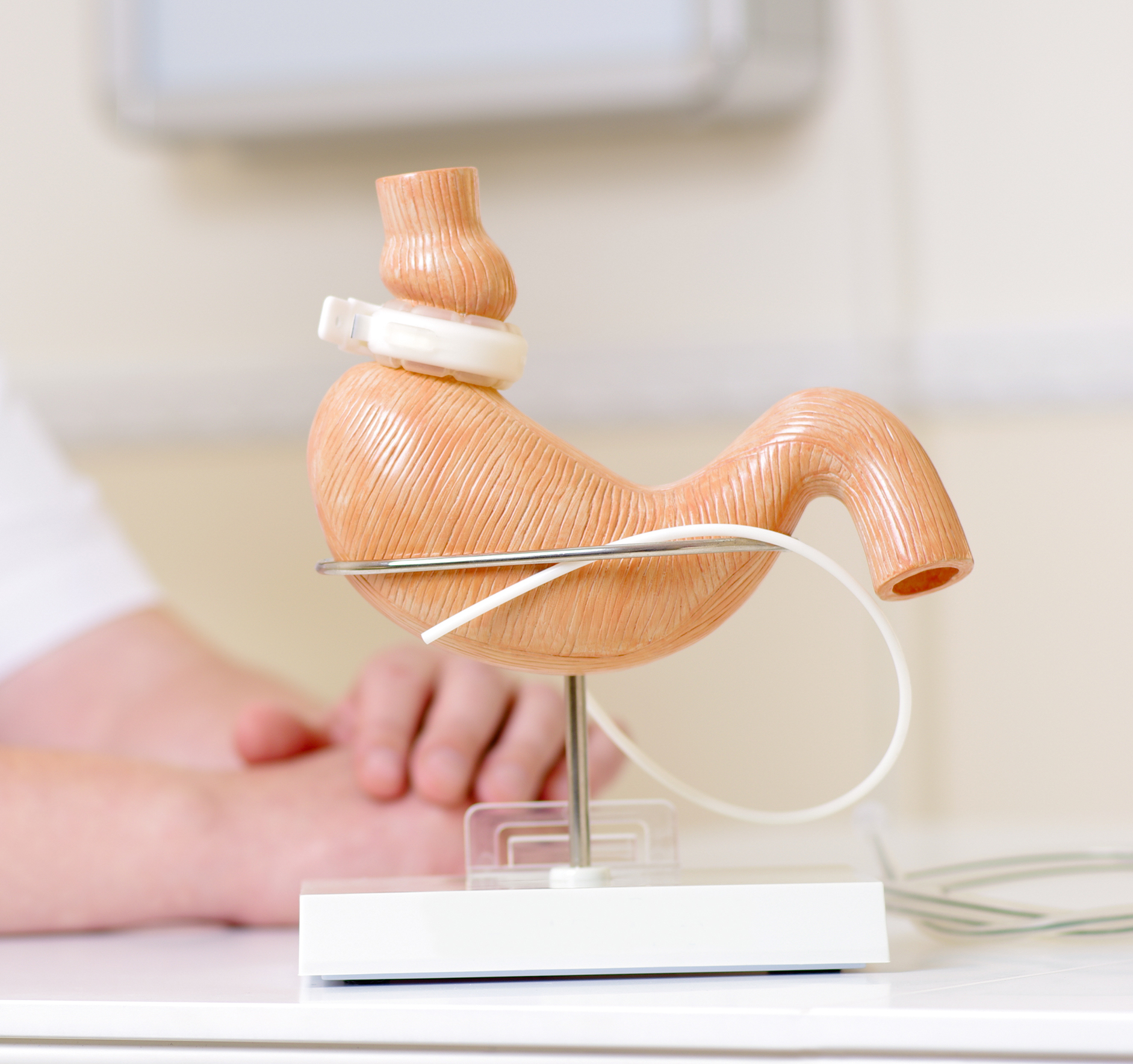 LAPBAND® Surgical Weight Loss Options
