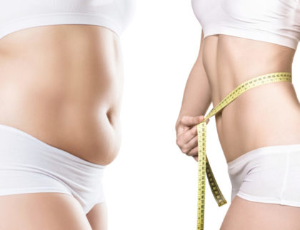 Your Complete Guide to Liposuction