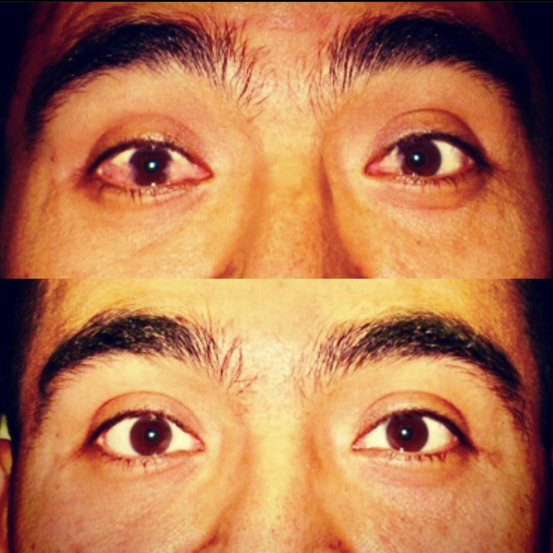 Eye 