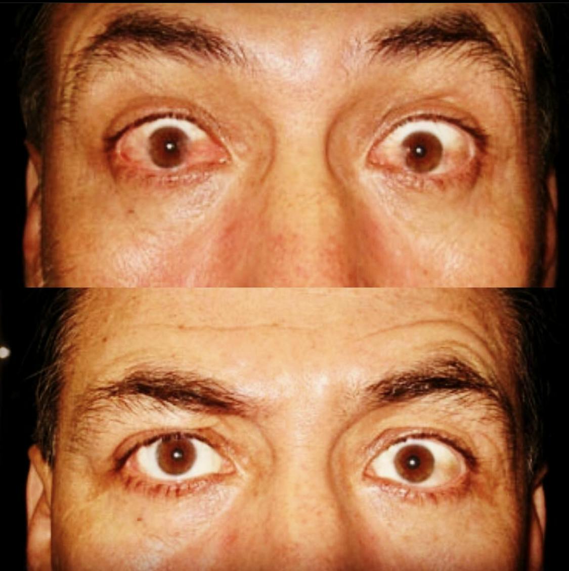 Eye 