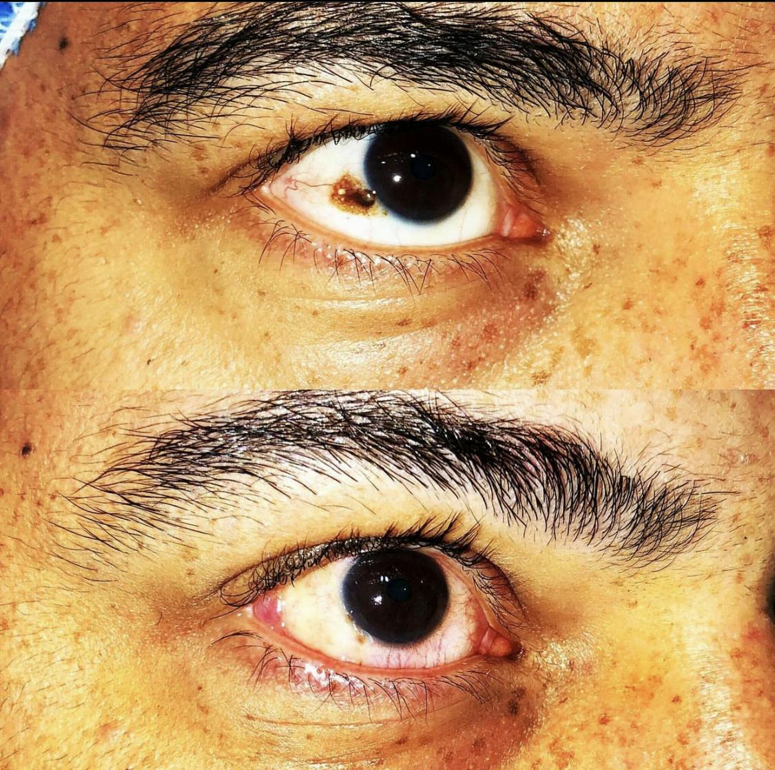 Eye 