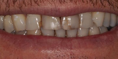 Patient Results Before & After Gallery - Patient 882685 - Image 1