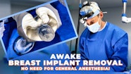 Breast Implant Removal Tampa Clearwater Dr Markelov