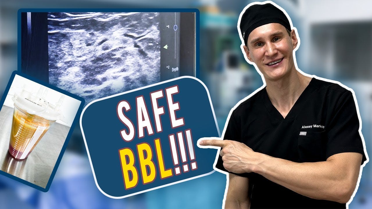 BBL youtube video thumbnail